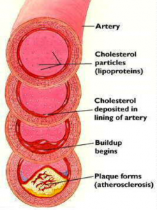 cholesterol-sources02